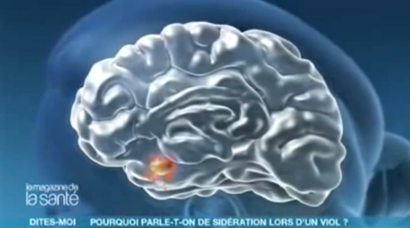 Comment fonctionne notre cerveau pendant une agression - Allo docteur - Amazon Training